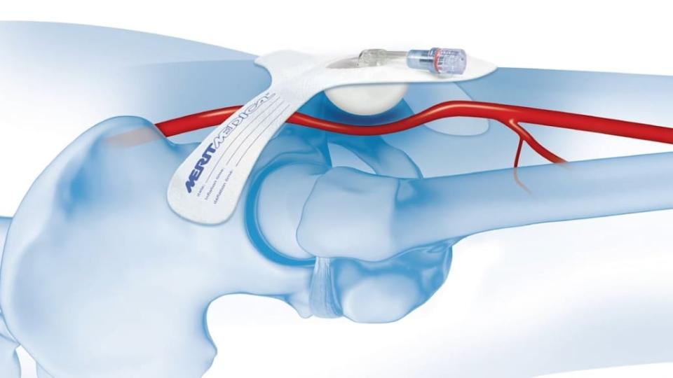 SAFEGUARD Banda de compresión femoral